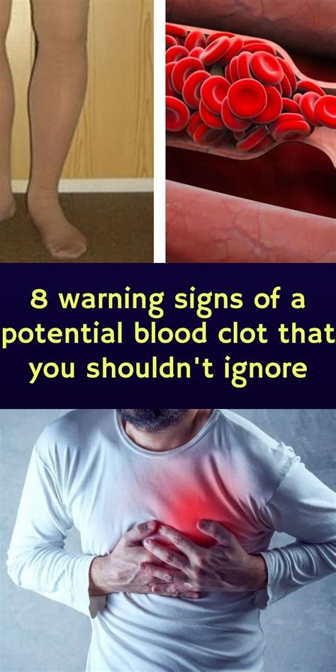 clotsity|6 Blood Clot Signs You Shouldn't Ignore .